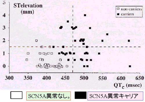 SCN5A異常を示す大家系における右側胸部誘導ST上昇度とQTｃとの相関